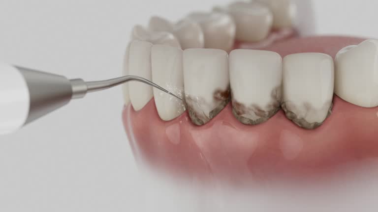 Reliable Wisdom Tooth Removal contractor in Clarke County County, IA by Dentist Open Now